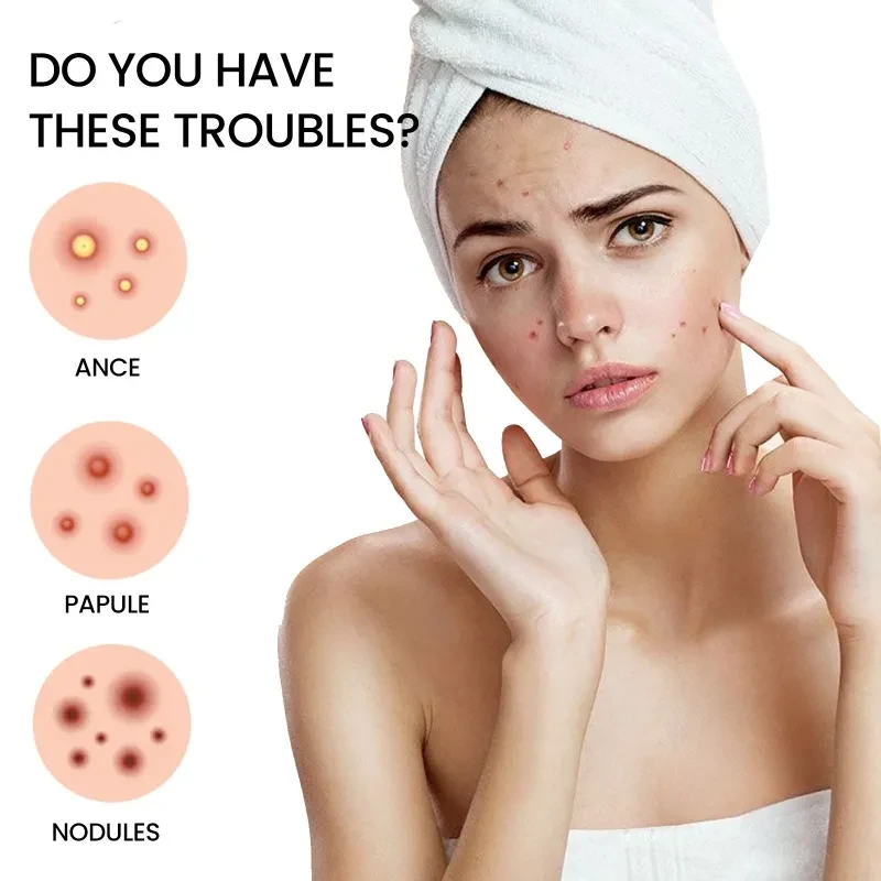 Hydrocolloid Pimples Patch Acne Spot Stickers for Whiteheads Papules Nodules
