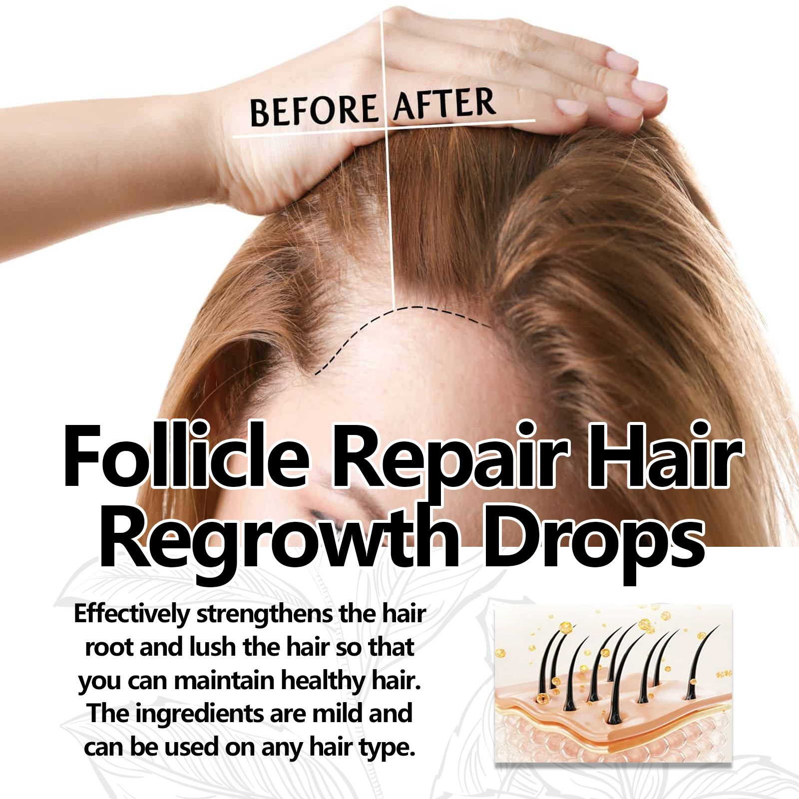 West Month Follicle Repair Hair Regrowth Drops