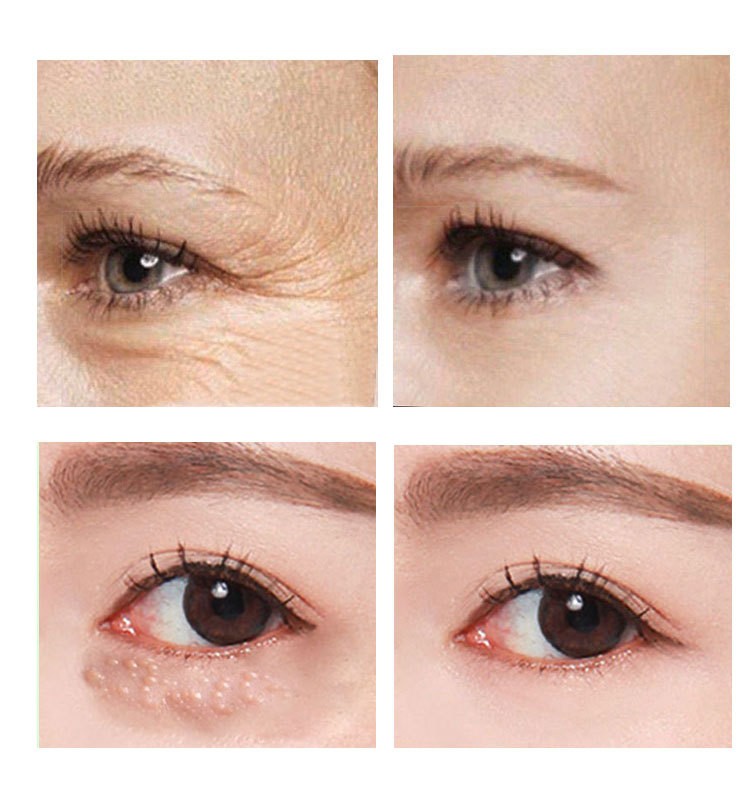 AnYi Beauty Eye Cream Target Dark Circles, Puffiness, and Fine Lines