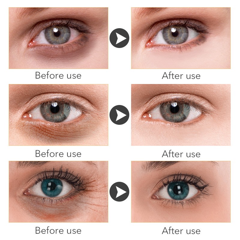 AnYi Beauty Eye Cream Target Dark Circles, Puffiness, and Fine Lines