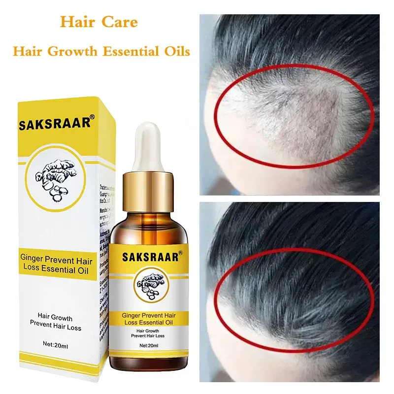 Ginger Hair Loss Products Natural With No Side Effects