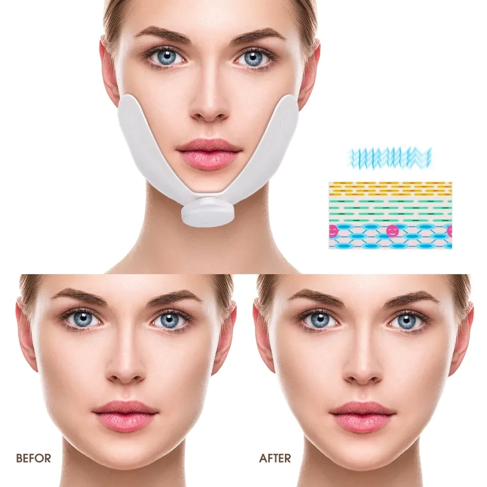 Facial Slimming Massager Women V Shape Facial Lifting Device