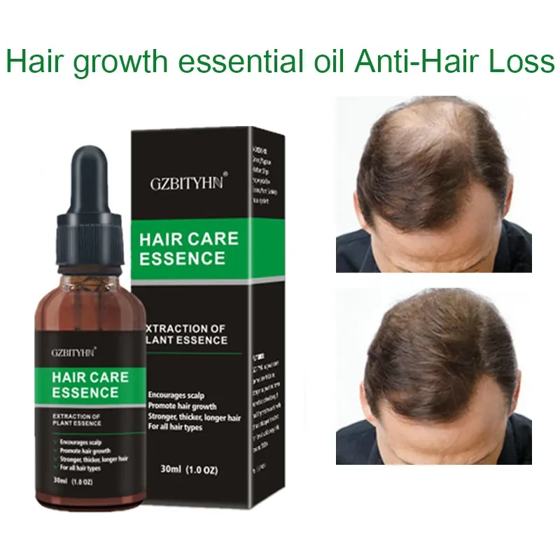 OEM Hair Care Essential Oil for Thicker, Healthier Hai