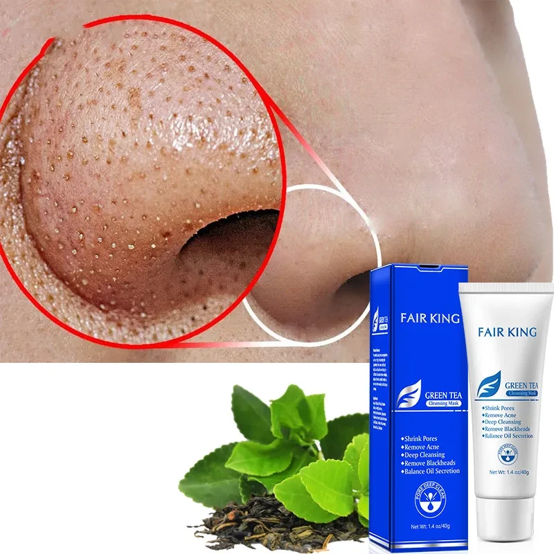 Green Tea Mask To Remove Blackheads And Oil