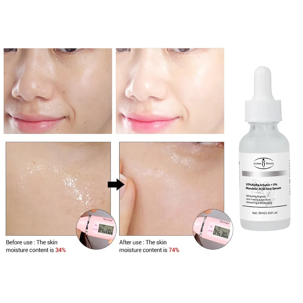 Fruit Glycoside Mandelic Acid Extract Facial Brightening