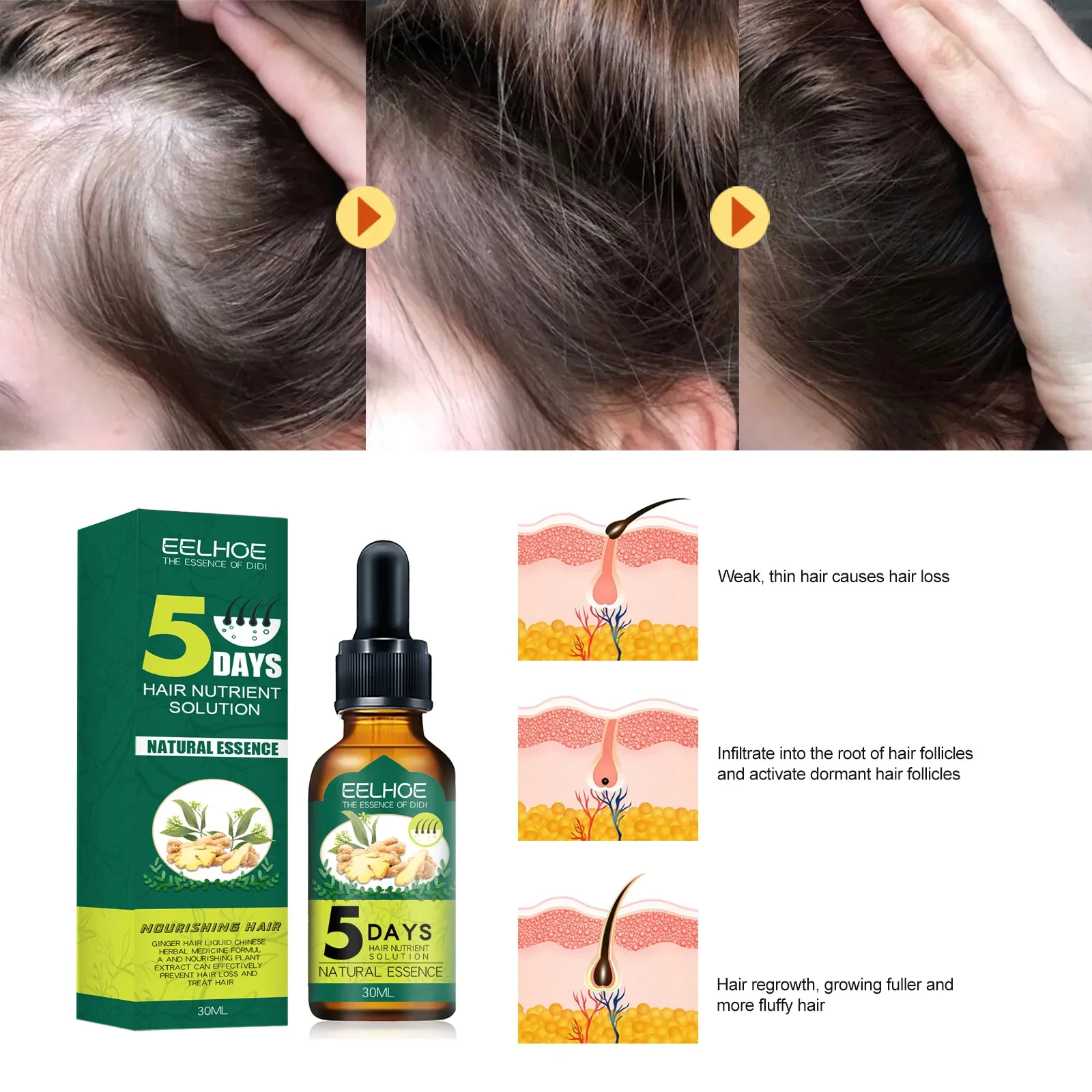 Household Ginger Hair Care Essential Oil
