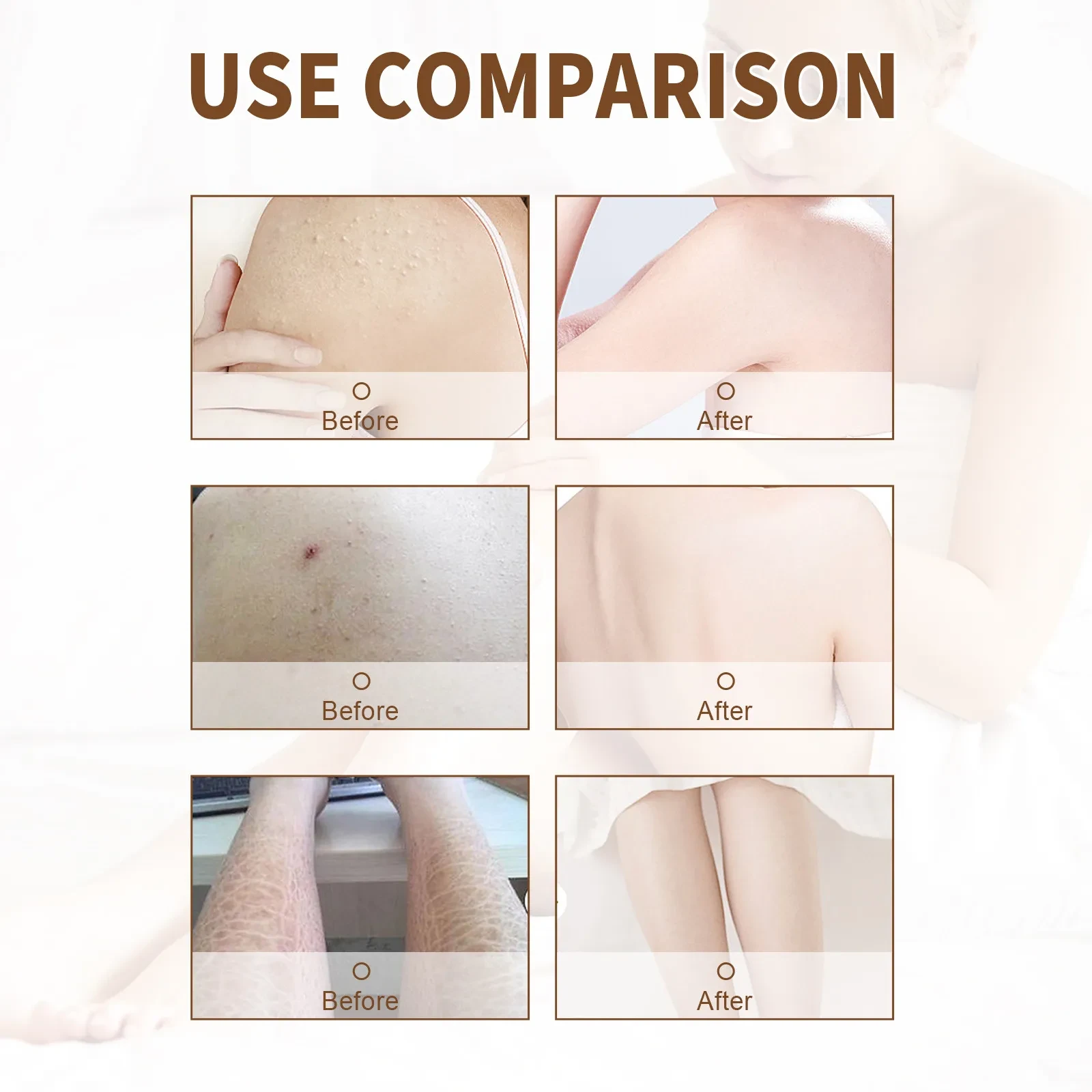 Chicken Skin Repair Cream Hair Follicle Cutin