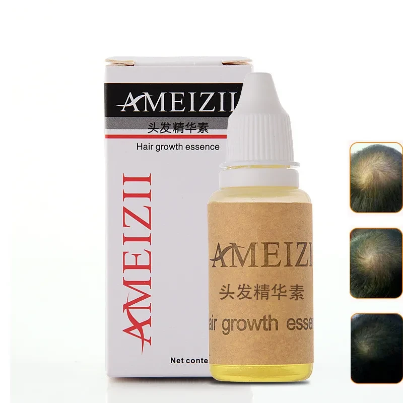 Unisex Ameizii Hair Ginger Shampoo Care