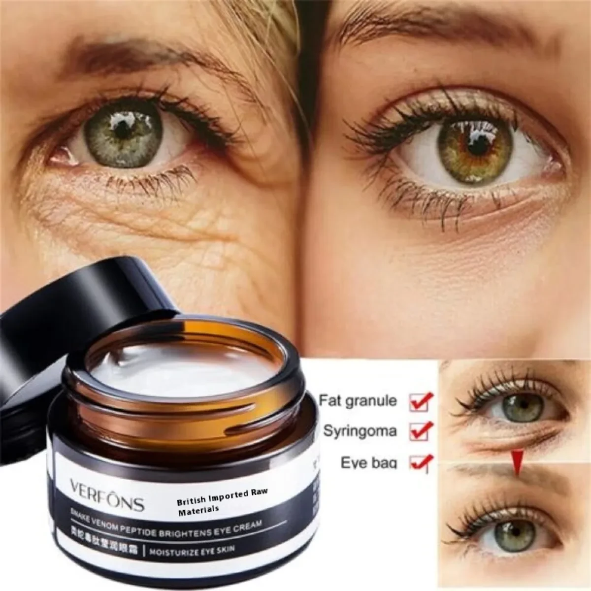 Anti Wrinkle Eye Cream - Retinol & Vitamin C - Fades Fine Lines & Dark Circles, Tightens Eye Contours, Eliminates & Bags