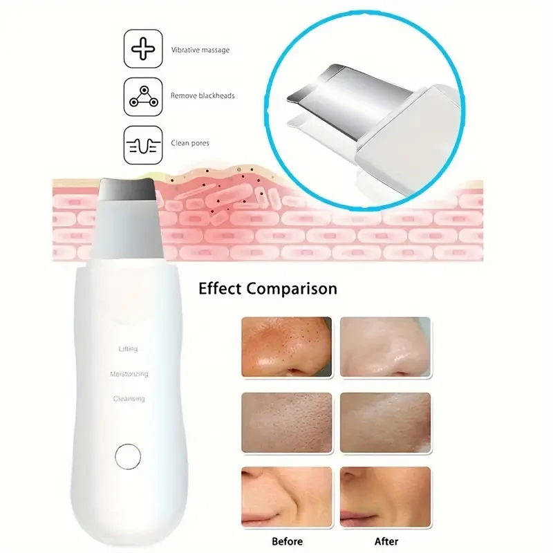USB Rechargeable Soundwave technology Facial Cleansing Device - Portable Blackhead & Pore Cleaner, Skin Care Tool