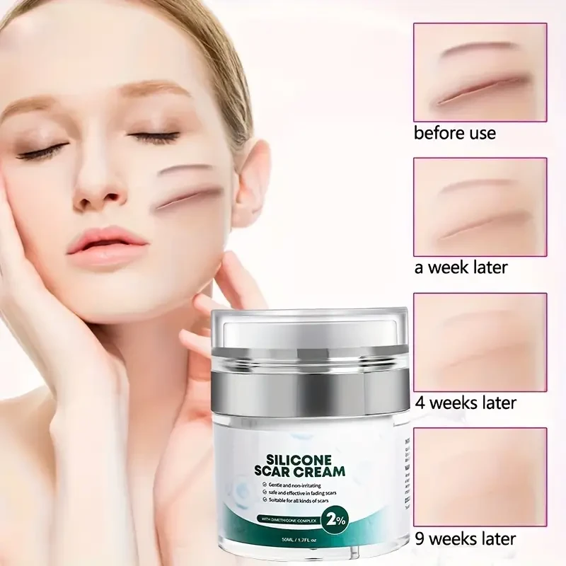 Scar Gel: Advanced Formula For Fading Scars, Acne Scars, Stretch Marks, And Surgical Scars - Skin Repair Treatment Containing Allantoin, Vitamin E, And Silicone Gel - Non-greasy And Quickly Absorbed.