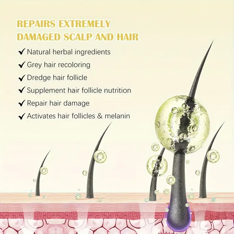 2PCS SEFUDUN Minoxidil Hair Growth drops, added biotin + 5% minoxidil formula, hair growth care and anti-hair loss product, scalp care for men and women, perfect for gift giving.