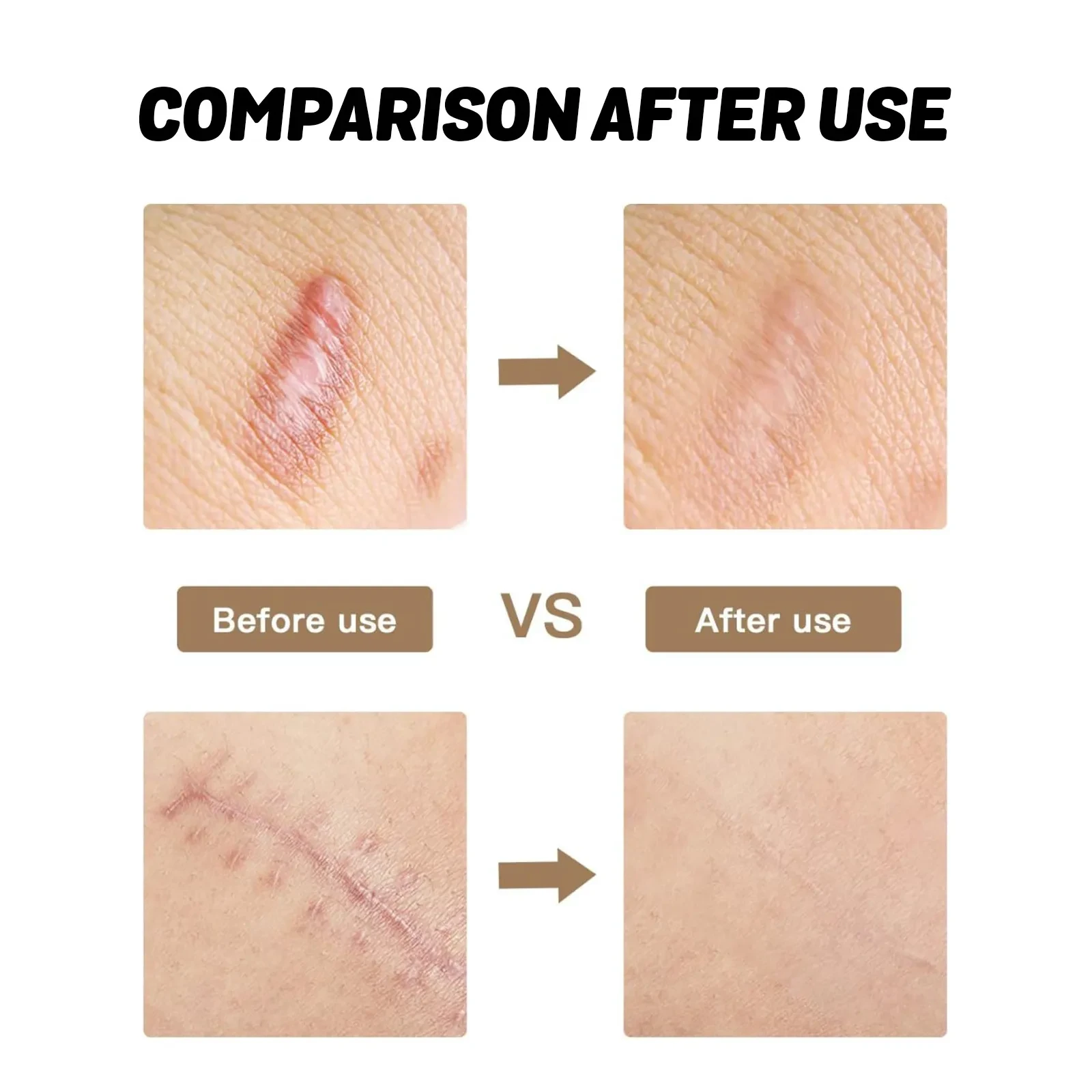 Skin Thinning Care Gel For Scar