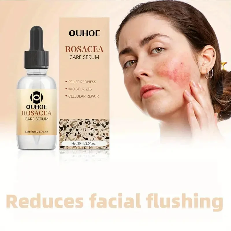 OUHOE Rosacea Care Serum, 60pcs, Facial Skincare, Essential Oils, Moisturizes & Nourishes, Reduces Skin Redness, Soothes & Eliminates Scaly Skin, Suitable for All Skin Types, with Glycerin, Tea Tree, Aloe Vera, and Urea