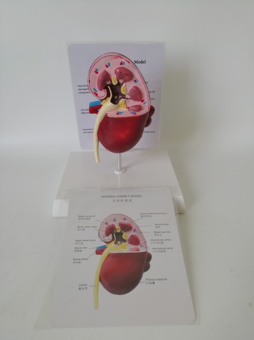 Anatomical Model Of Kidney Stone Pet Dog Lesion