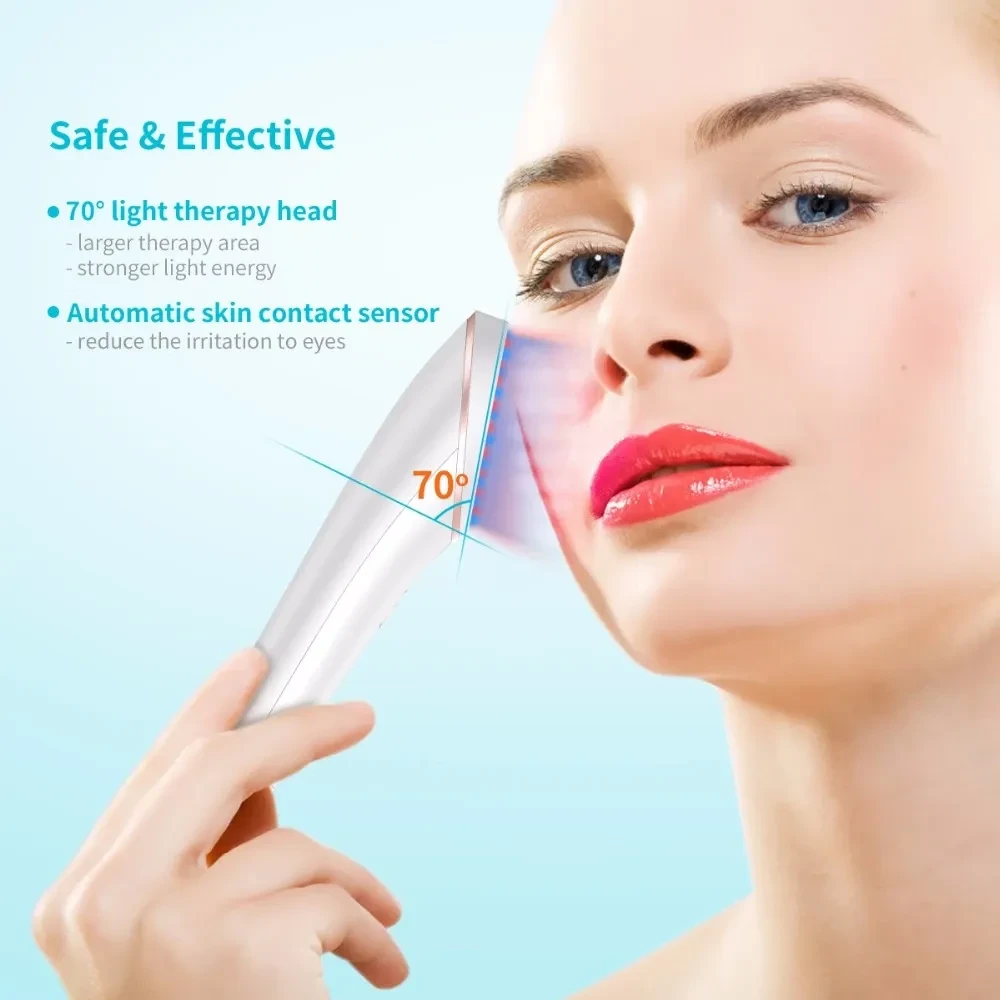 Xpreen Acne Light Therapy Device