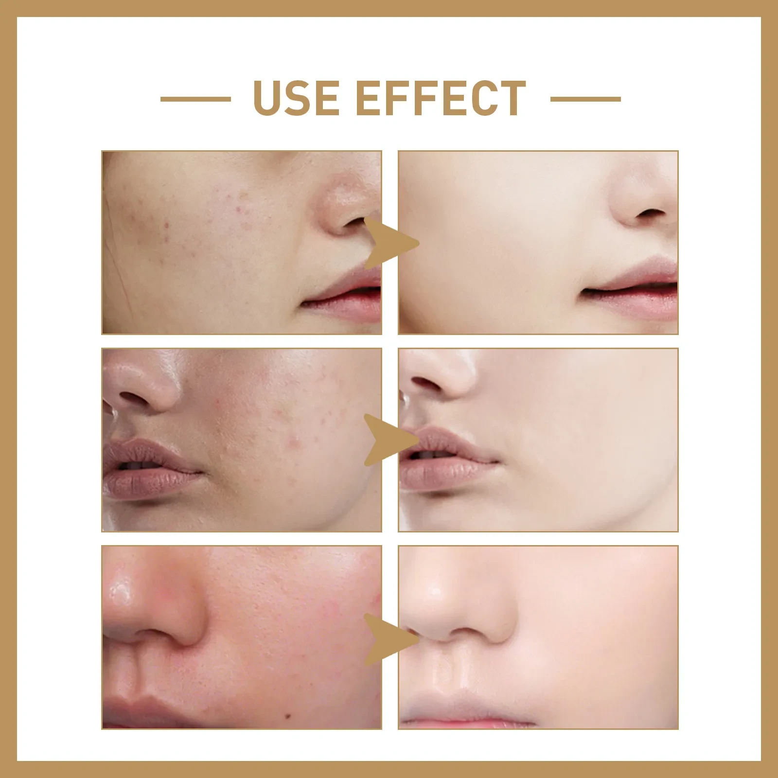 Repair Skin Barrier Deep Hydrating And Firming Soft Facial Skin Lotion