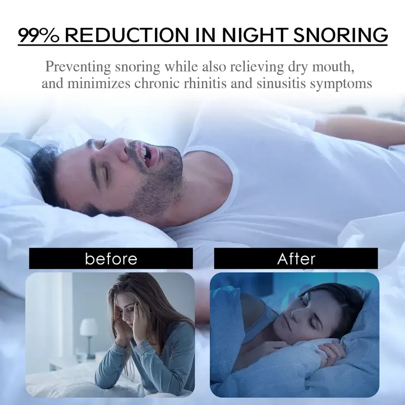 Anti-snoring Patch for Breathing and Snoring Care