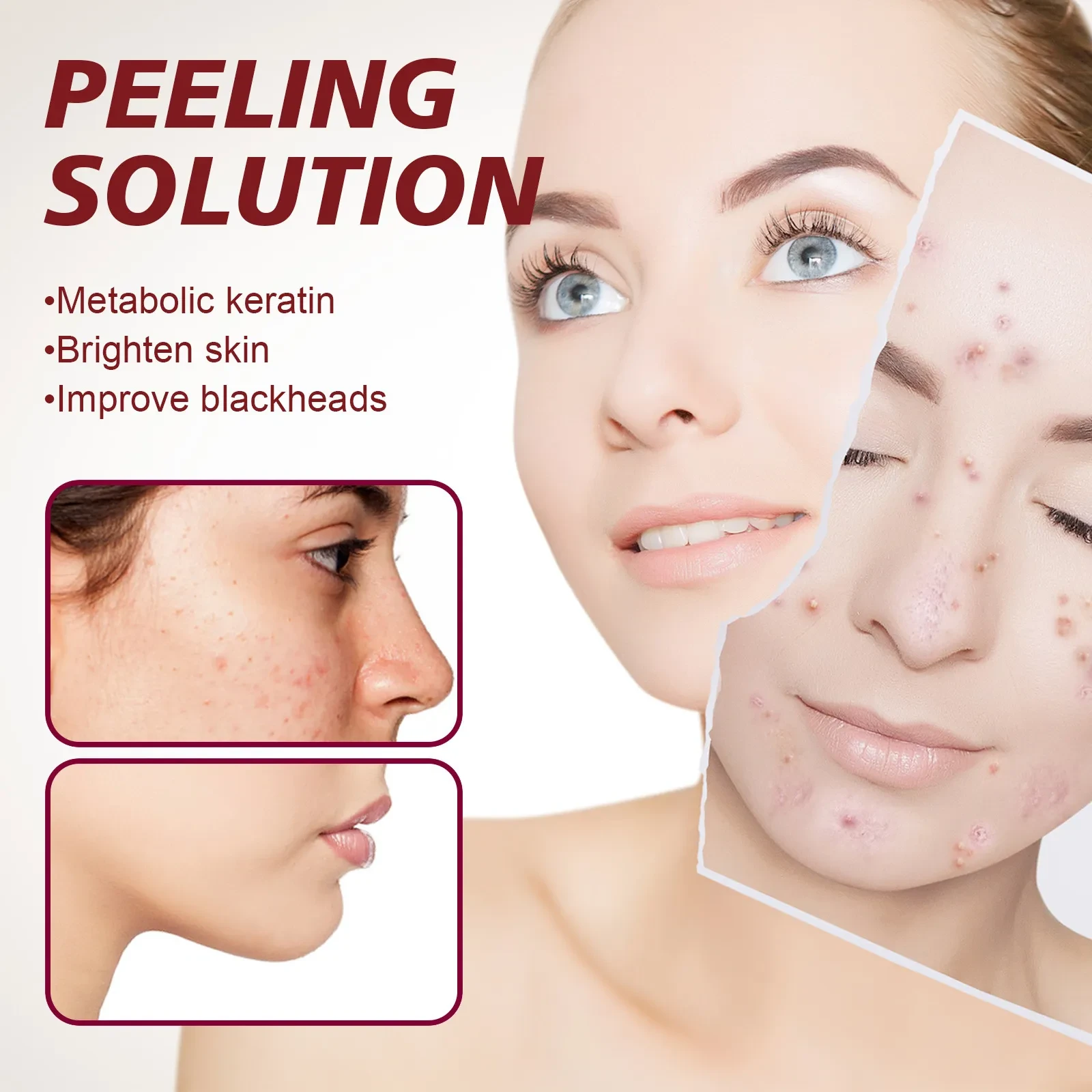 Tender Pores Moisturizing And Softening Cutin Skin Fading Spots