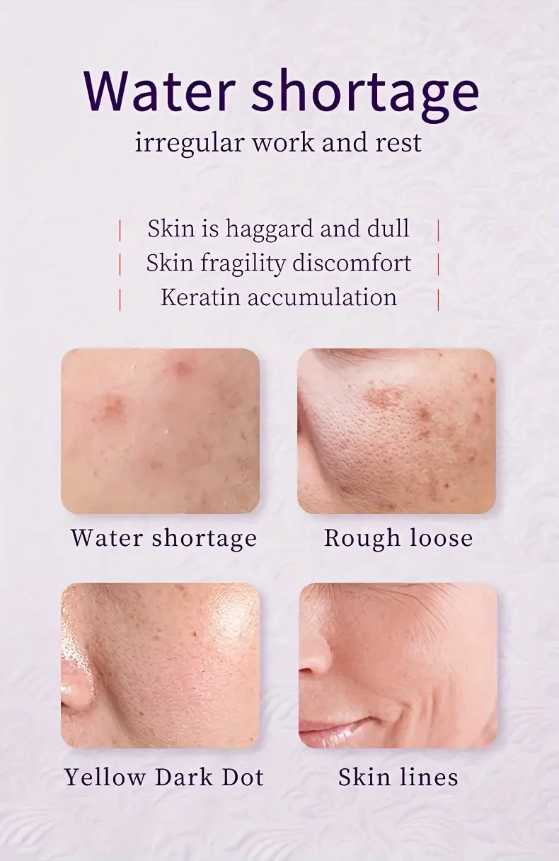 HANMJ 6pcs Perilla Soothing Moisturizer Set, Hypoallergenic Facial Skincare, Evens Skin Tone, Enhances Radiance, Rejuvenating Beauty Routine