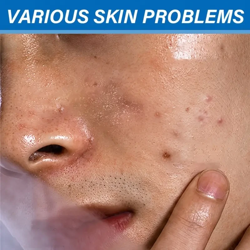 Men'S Skin Care Set Contains Volcanic Mud Cleanser, Strong Adsorption, Rich Foam, Deep Cleansing, Snow Mountain Cream, Mild Ingredients, One Touch of Absorption, Moisturizing, Care for The Skin, Making The Skin Smoother And More Delicate