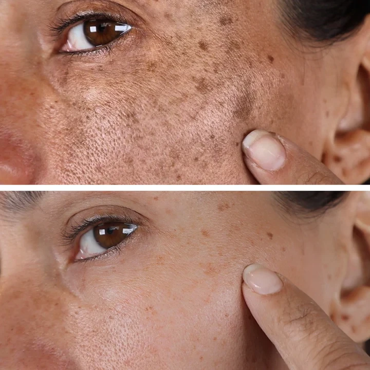 AQA Melanin Correcting Brightening Serum - Advanced Anti-Aging & Dark Spot Treatment
