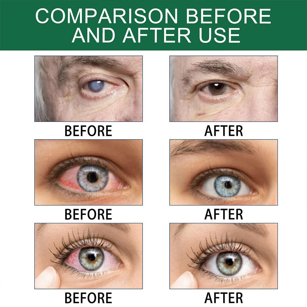 LuxVision High-End Eye Relief Drops