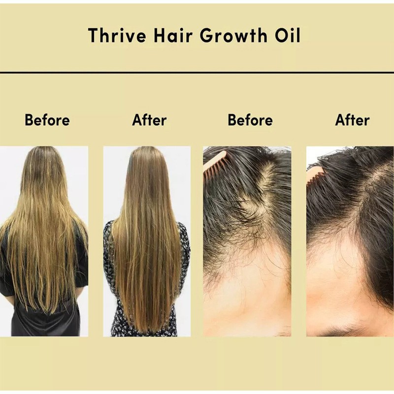 Veganic Natural Hair Growth Oil - Anti Hair Loss and Nourishing Essential Oil for Hair Thickening and Repair