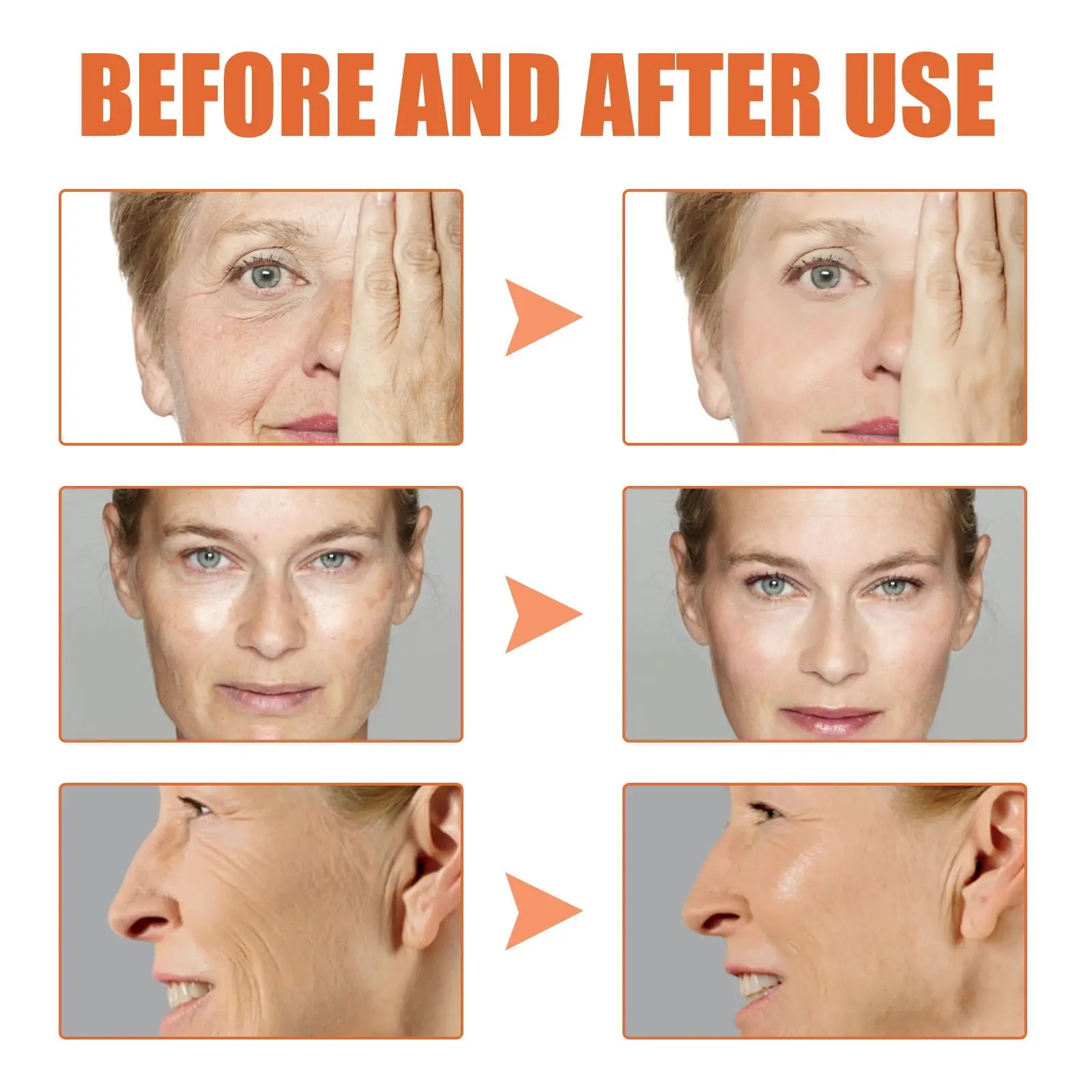 B5 Anti Wrinkle Face Serum with Hyaluronic Acid - Anti Aging, Lift and Tighten