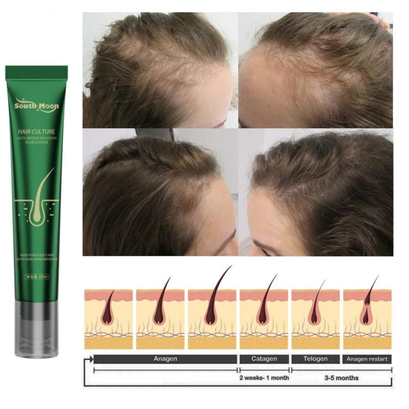 South Moon Anti-Hair Growth Essence - Strengthens Hair and Repairs Root Damage with Ginger Conditioning