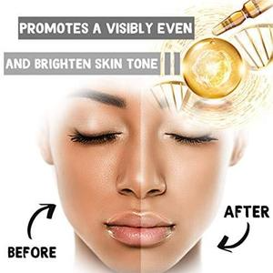 Anti-sunburn and blemish moisturizing cream