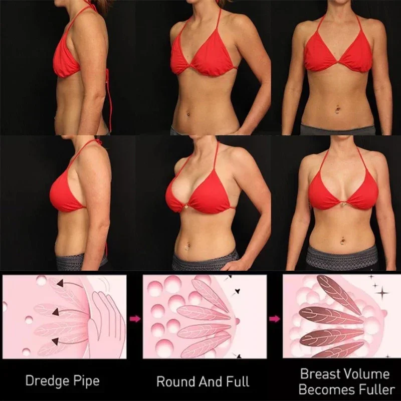 Natural Breast Enlargement Cream - Lift and Firm