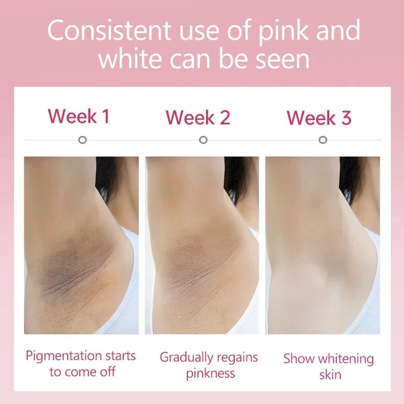 Body Whitening Cream - Intimate Area Brightening Lotion