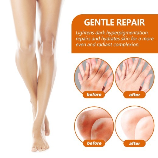 Black Ratchet Repair Joint Black Whitening Brightening