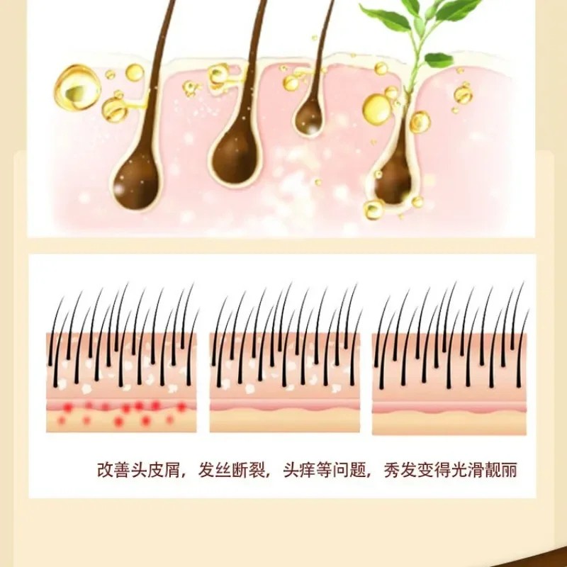 Sulfur Shampoo for Lice, Mites, Dandruff, and Itching Oil Control, Deep Cleaning, Damage Repair