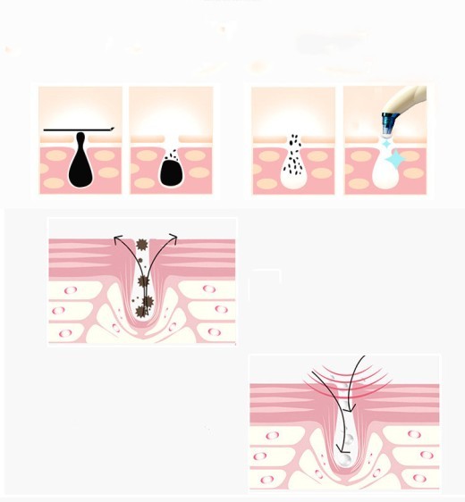 Electric Blackheads Remover Blackheads Artifact Household Pore Cleaner Microcrystalline Beauty Apparatus