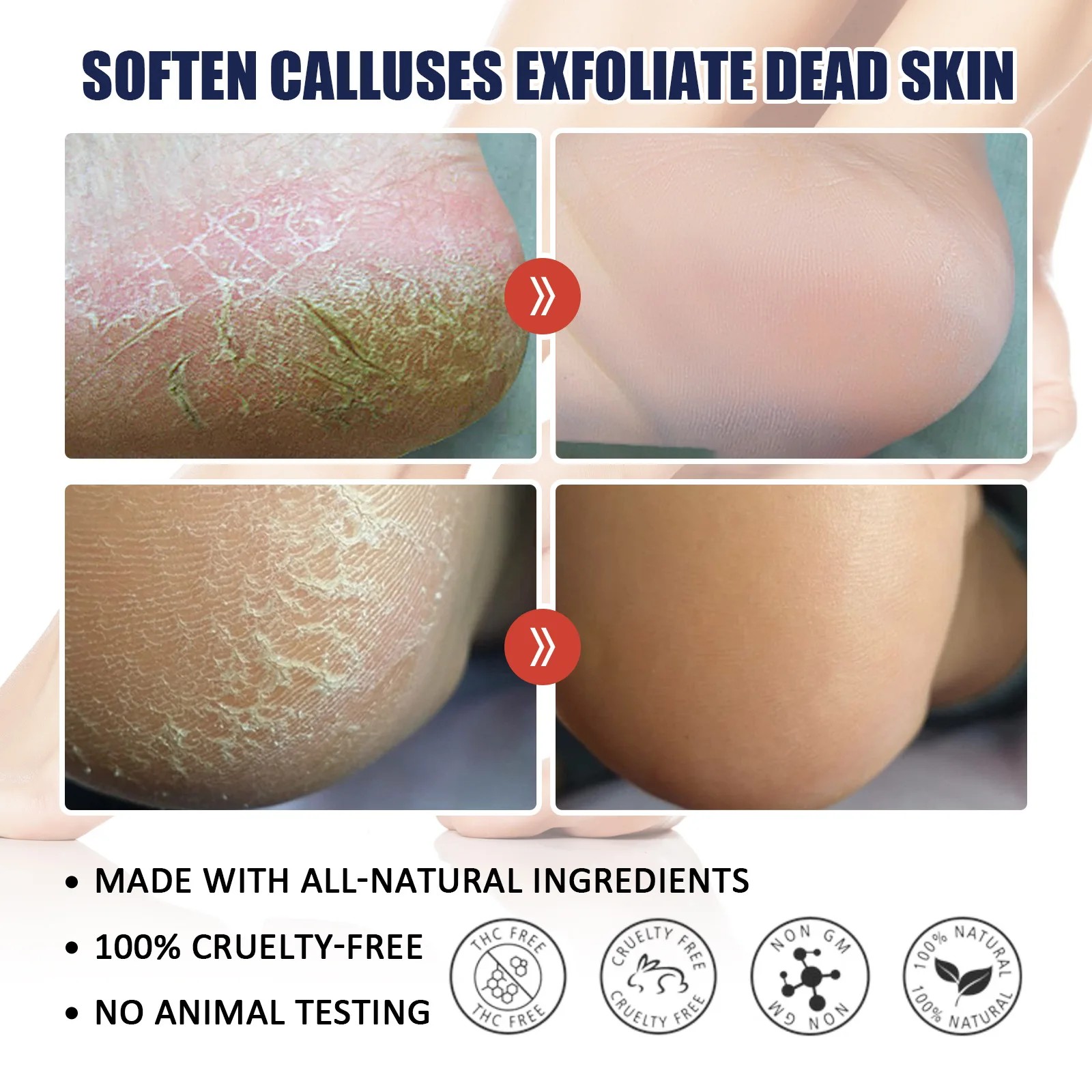 Anti-Drying Crack Hand & Foot Care Cream - Heel Repair & Skin Moisturizer