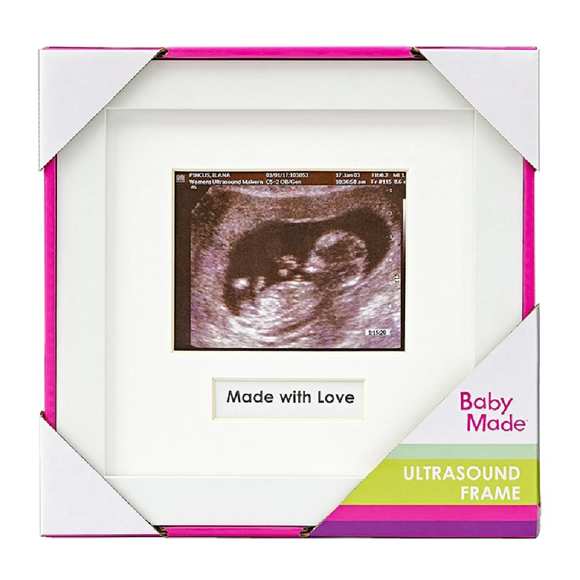 Sonogram Picture Frame