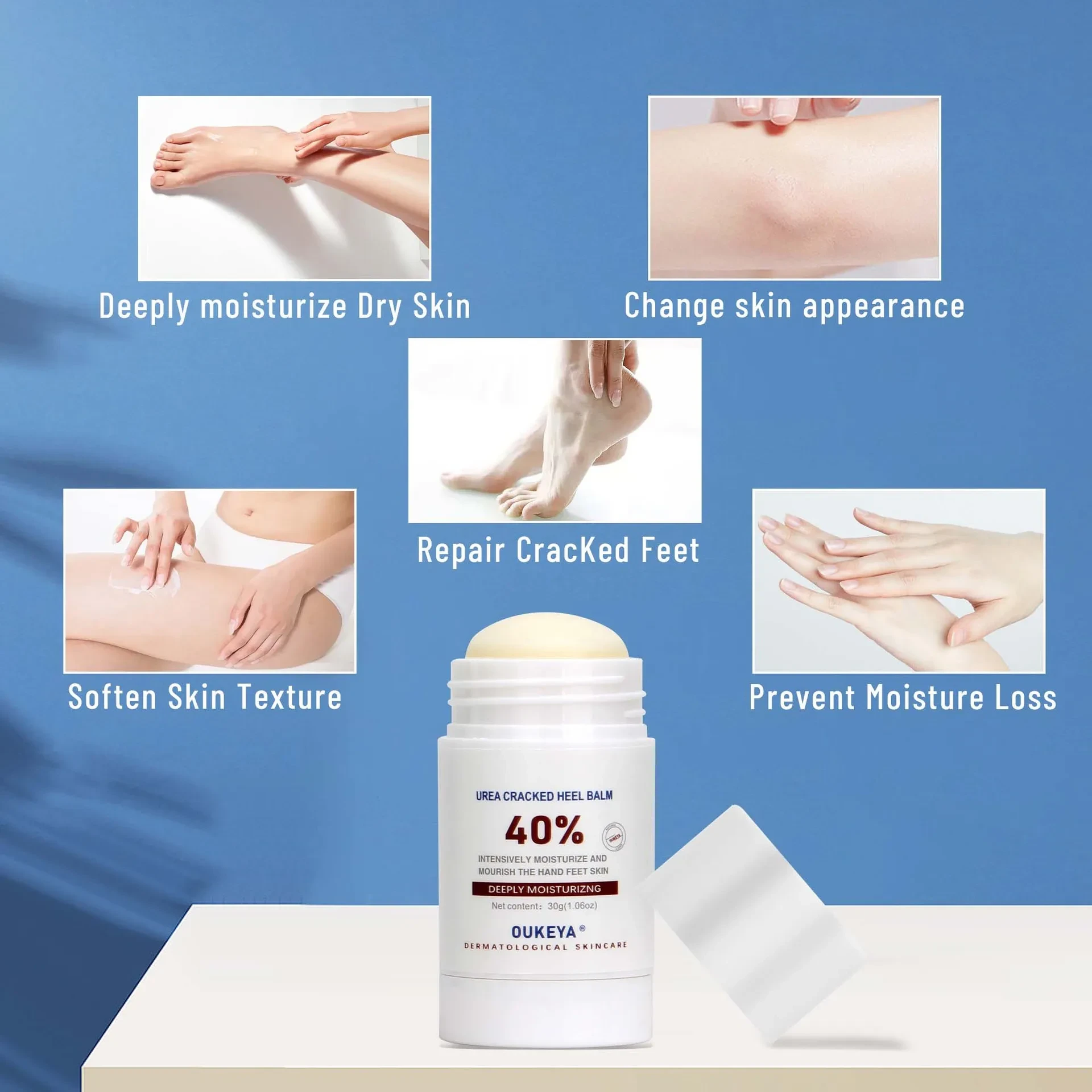 Cross-border Urea Cream 40 Heel Crack Repair Neck Cream