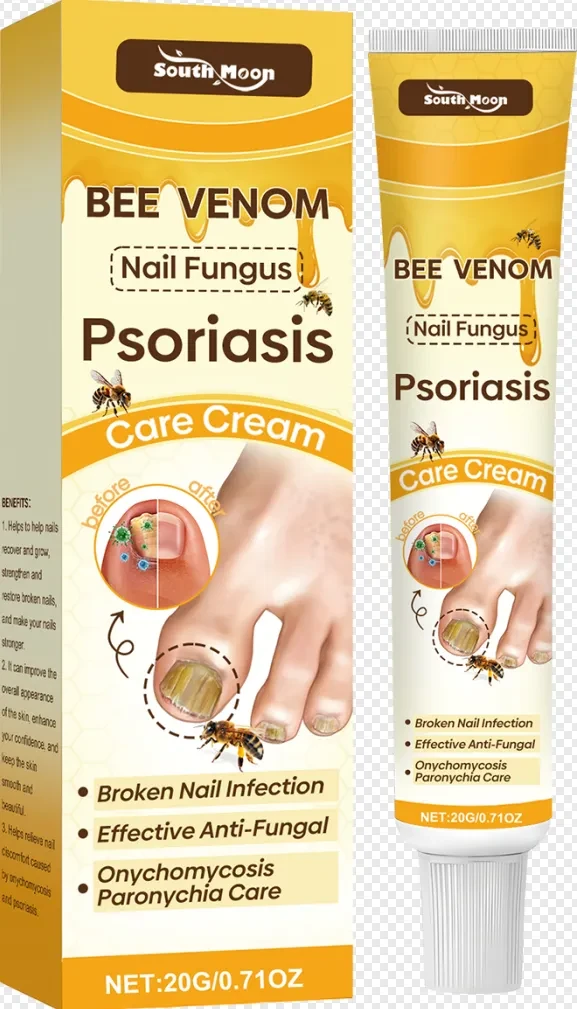 SOUTH MOON Bee Venom Psoriasis