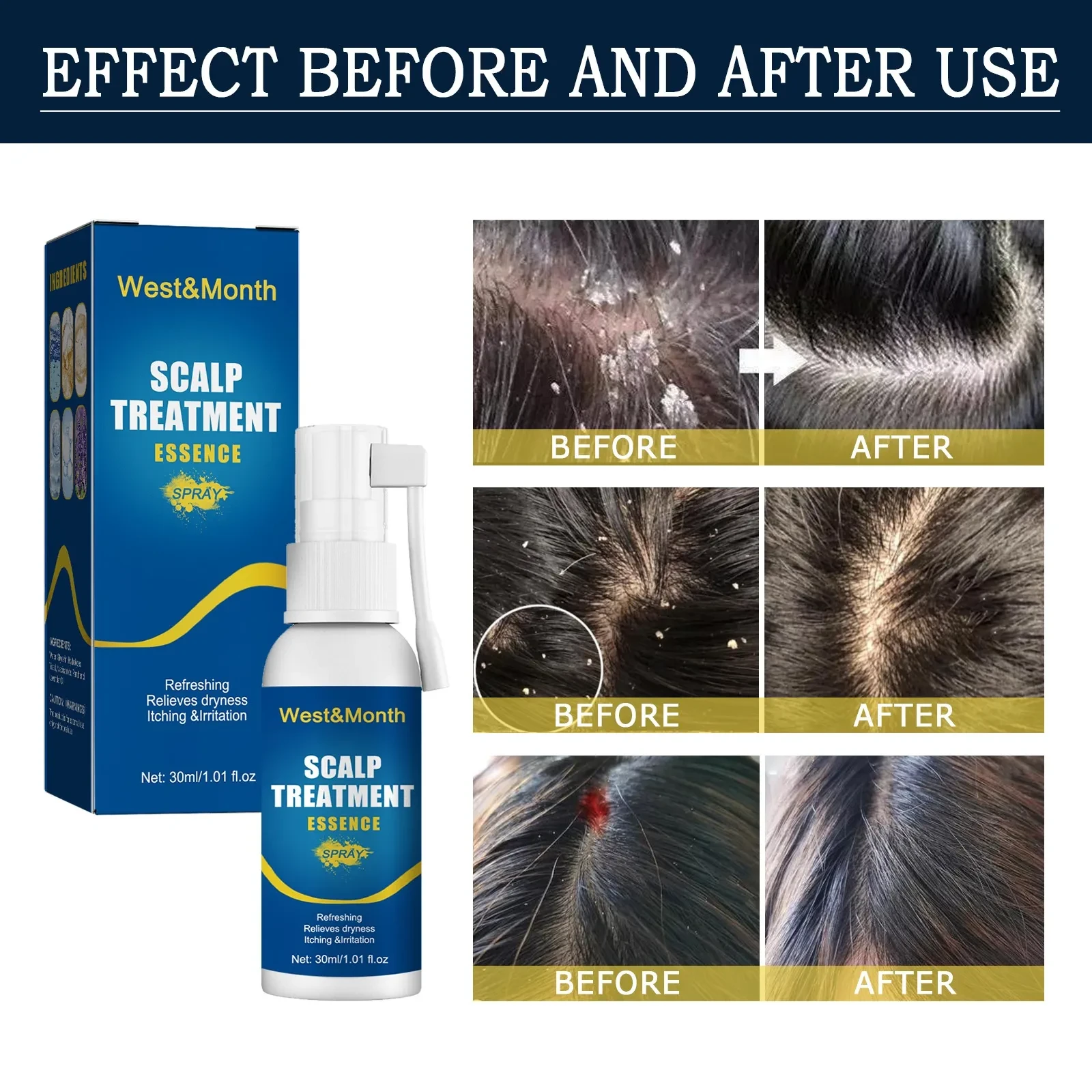 WEST & MONTH Scalp Treatment Essence