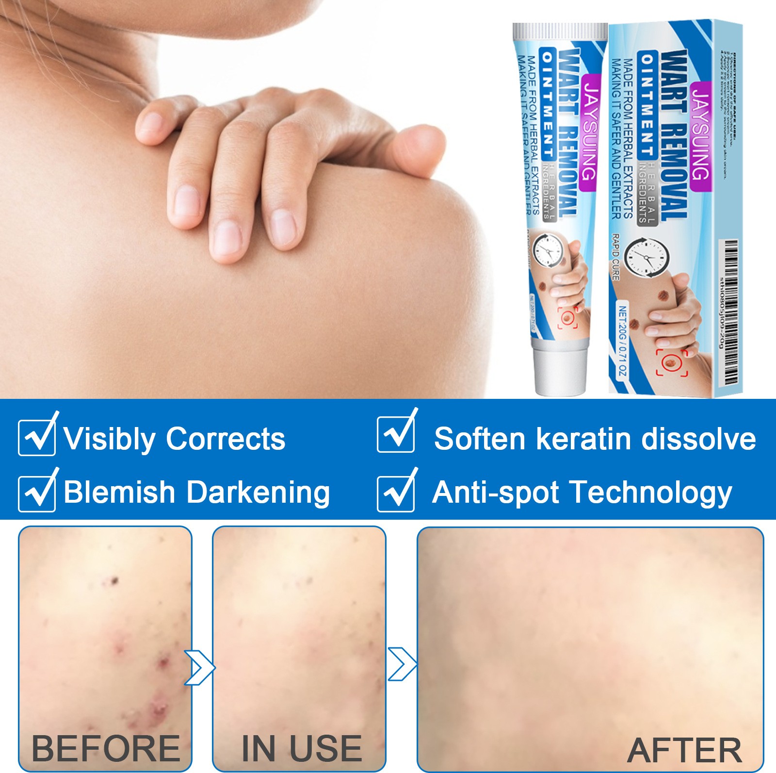 External Body Skin Care Emulsifiable Paste