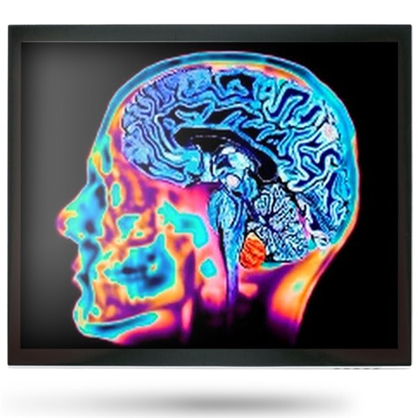 Onyx MEDDP-415HNN 15" Medical Display