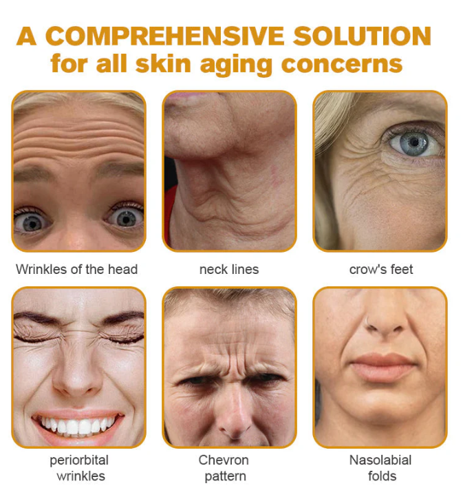 AWZLOVE Bee Venom Comprehensive Cream