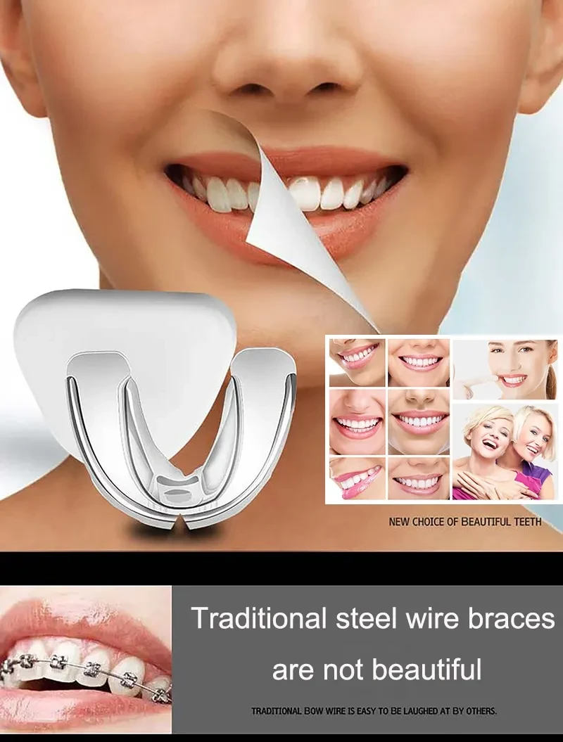 Elastics For Braces