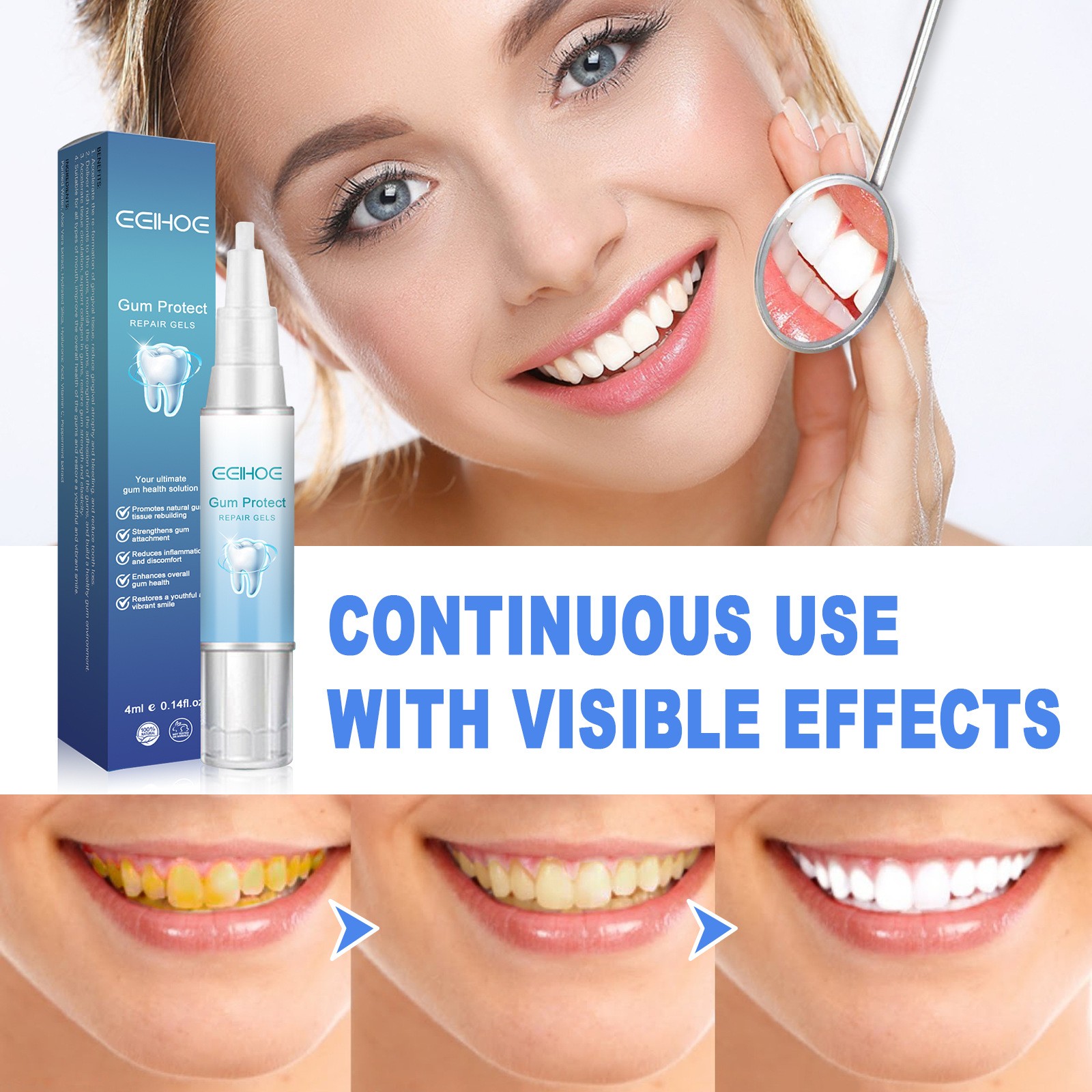 Gum Shield Therapy Gel