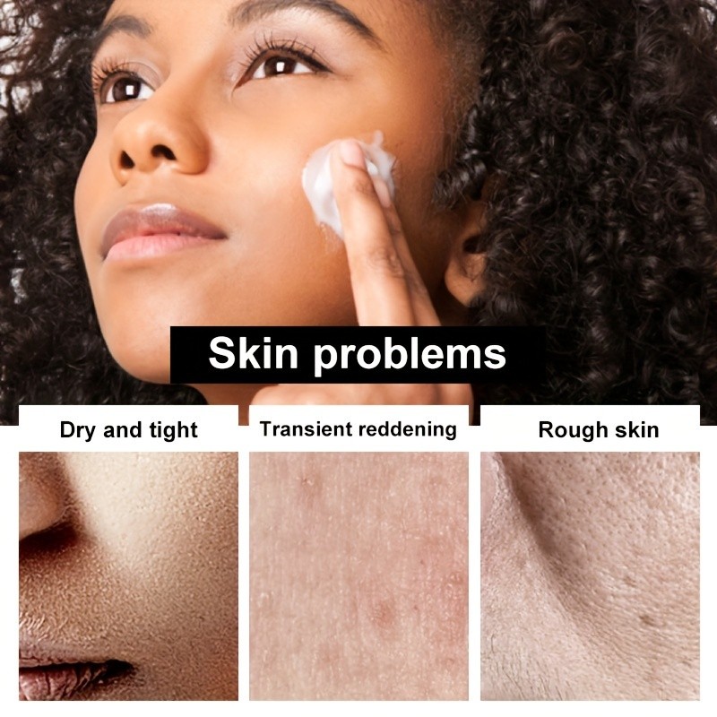 SUMAX Hydrating Face Cream Ceramide & Hyaluronic Acid Moisture Barrier Enhancing Cream (150g)