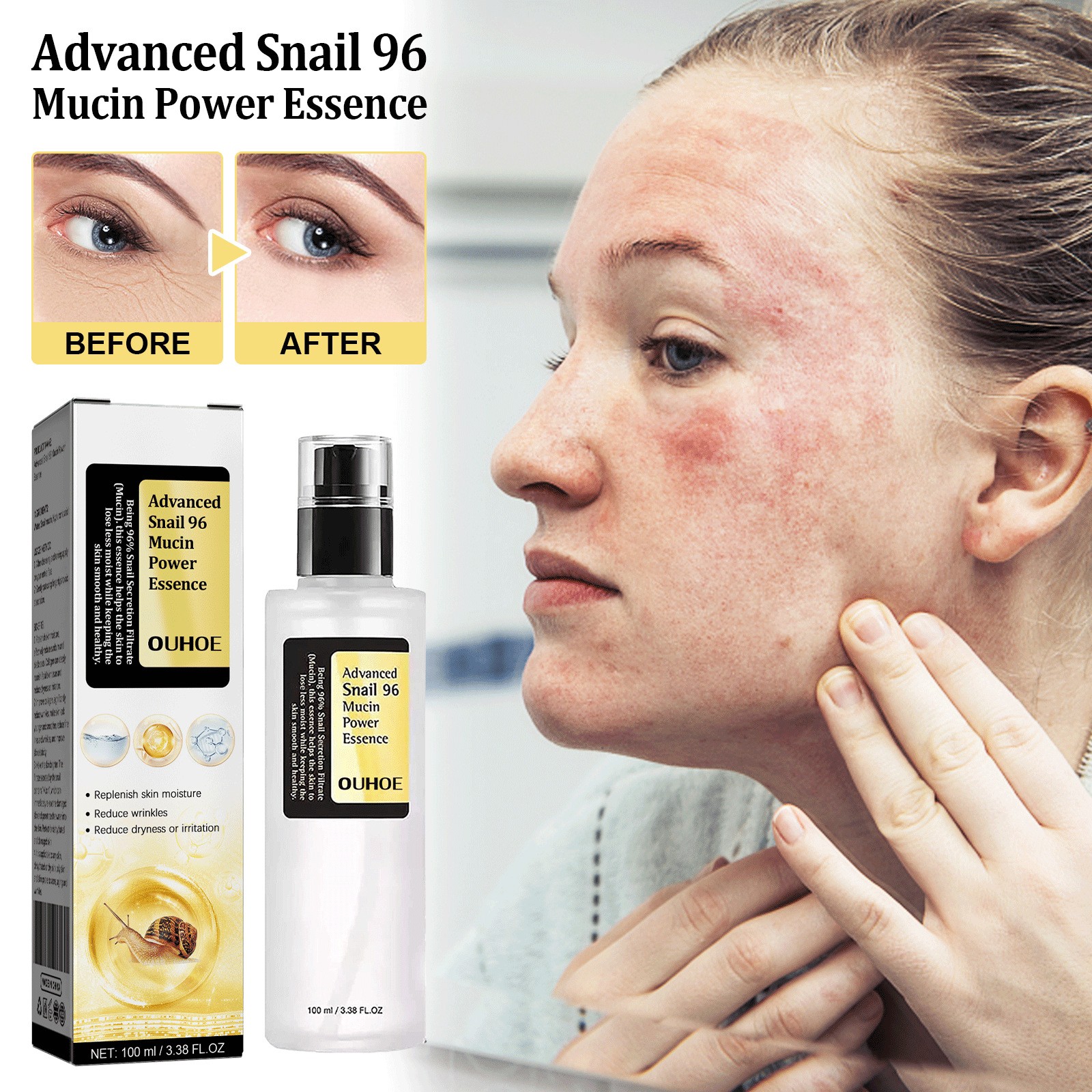 OUHOE Advanced Snail 96 Mucin Power Essence