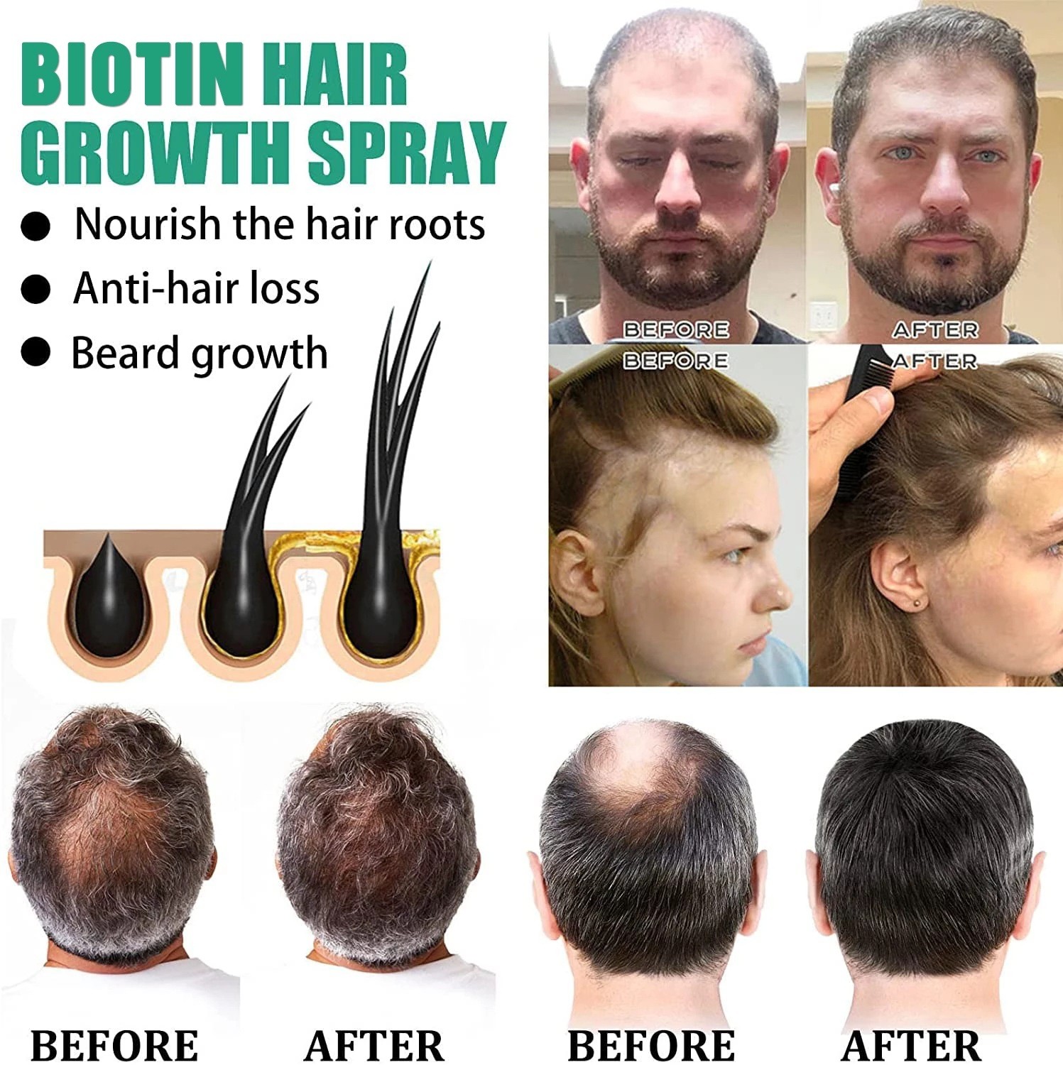 Biotin Hair Growth Serum