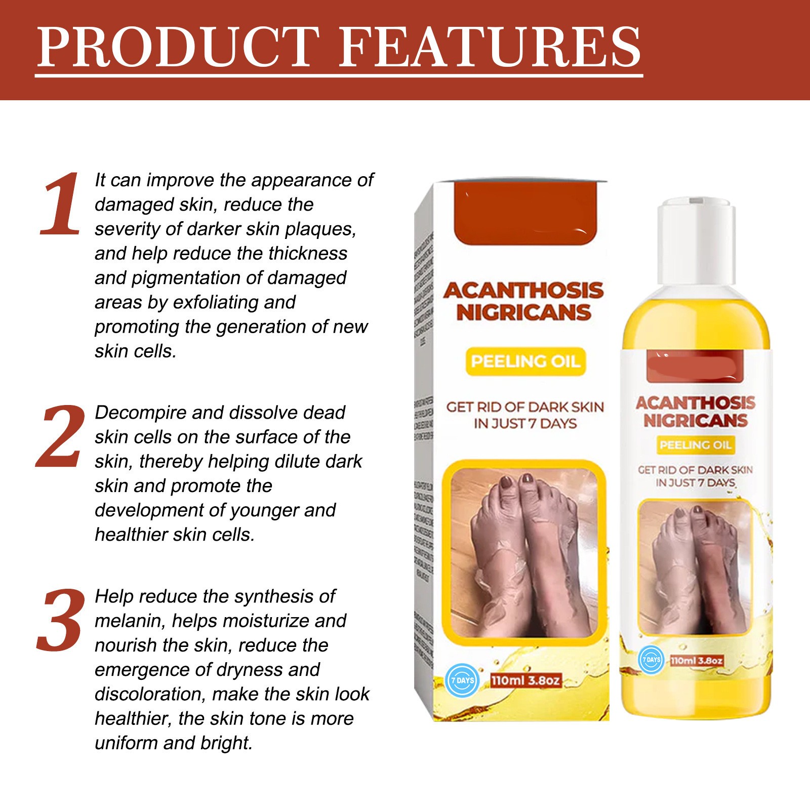 Acanthosis Nigricans Peeling Oil Remove Dark Skin in Just 7 Days